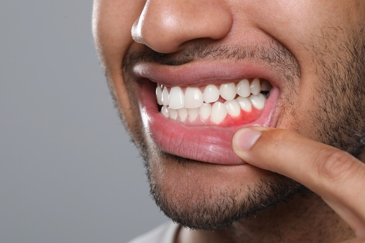 person with early gum disease